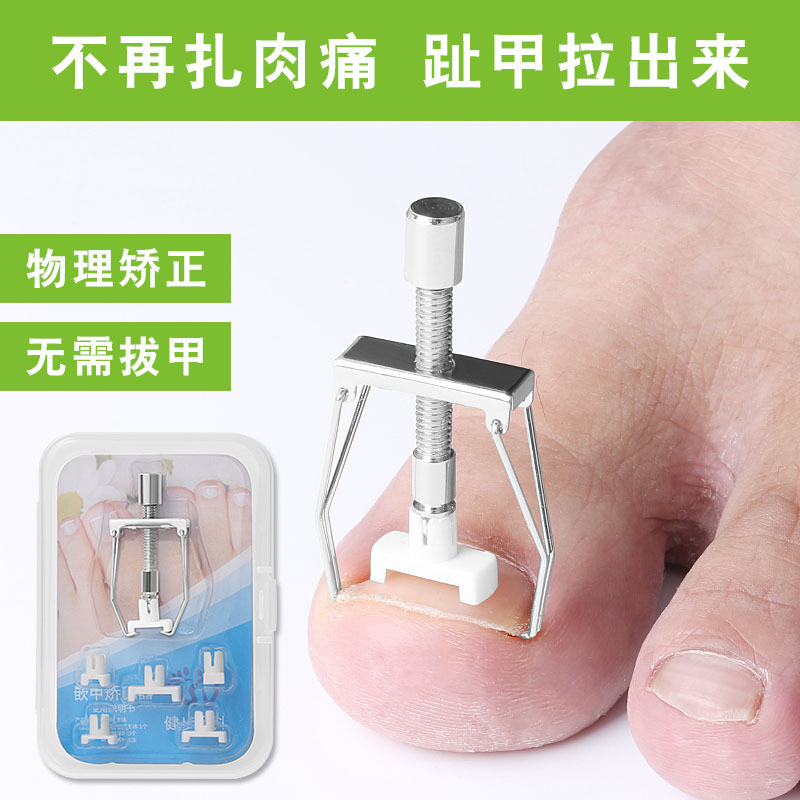 Stainless Steel Ingrown Toenail Corrector Set, Nail Groove Correction Device, Toenail Puller Physical Corrector
