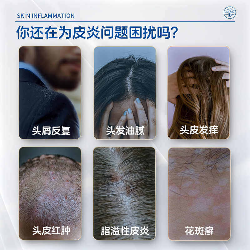 999 2.5%二硫化硒洗剂:头皮屑、脂溢性皮炎、头癣、止痒、毛囊炎的终结者?-癣症-淘宝百科网