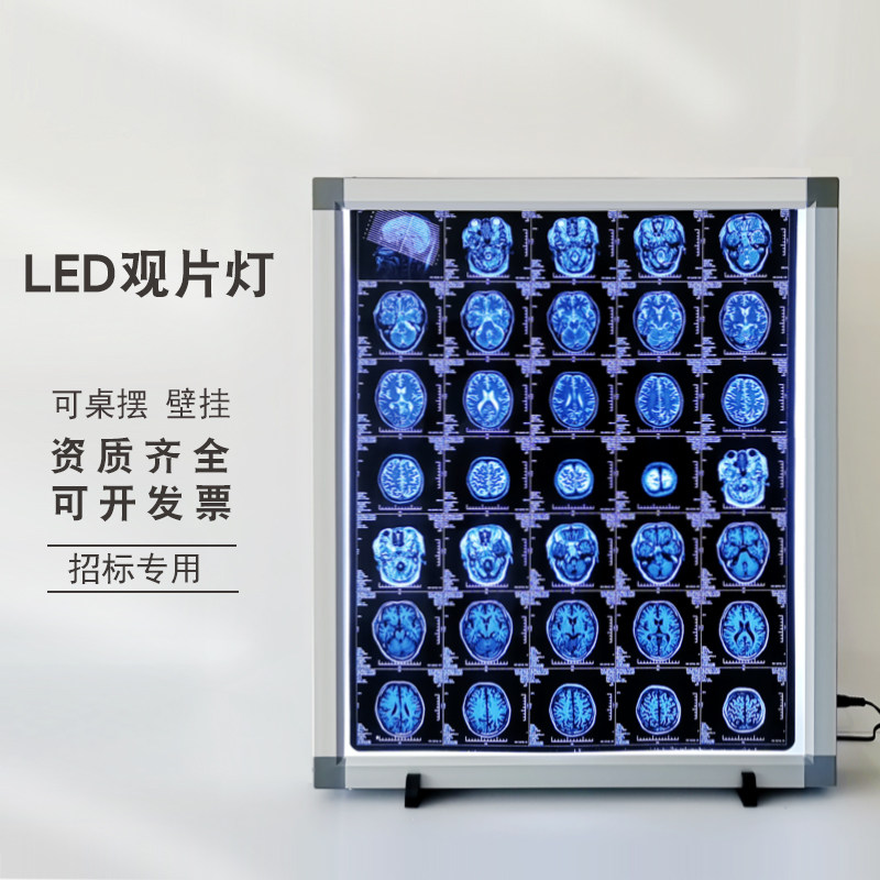 包邮X光阅片灯led观片灯箱超薄牙科看片CT灯单双三联观片灯骨科