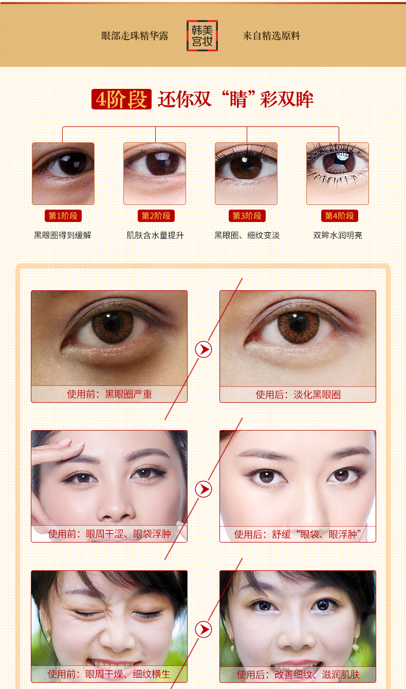 Golden Silk Jade Eyes Eye Drops Eye Cream Care Moisturising Lightening Dark Circle Eye Bag Fine Fine Firming kem dưỡng mắt clinique
