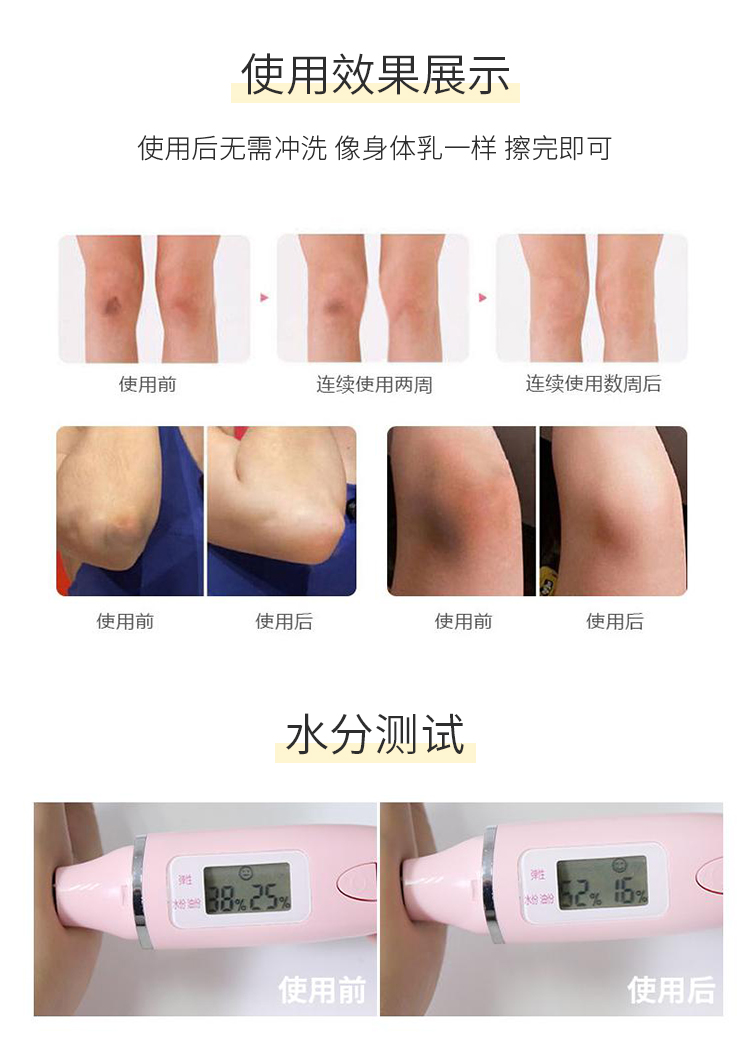 Nhật Bản maputi bộ phận tư nhân làm trắng da khử mùi chăm sóc melatonin cơ thể sữa bột kem mềm 黑色 melanin kem dưỡng trắng da toàn thân