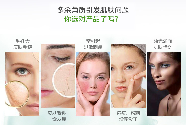 Úc Kosmea 蔻 美 Mặt nạ tẩy tế bào chết mặt sửa chữa mặt nạ làm sạch sâu tẩy tế bào chết hoá học cho da dầu