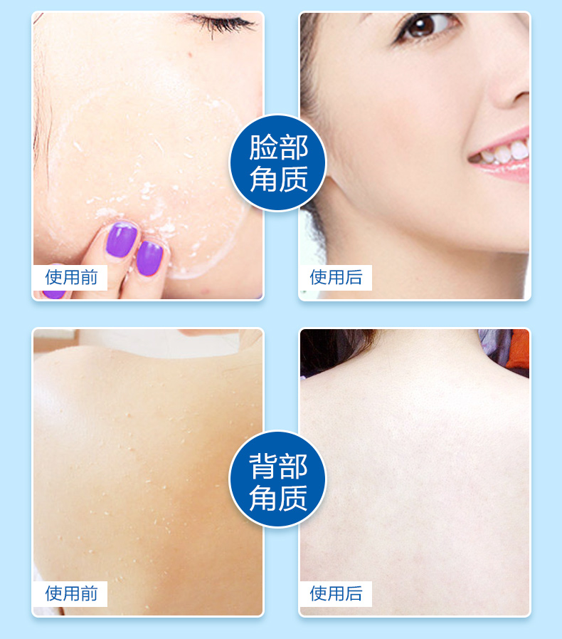 Tẩy tế bào chết cho nam Nữ tẩy tế bào chết Gel trị mụn đầu đen các loại tẩy tế bào chết
