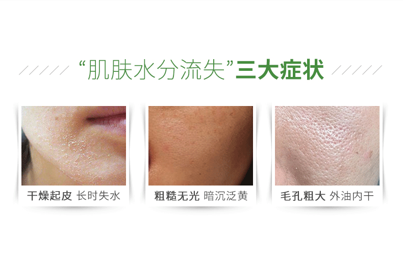 Kem dưỡng ẩm dưỡng da LOVEISDERMA Essence Ceramide Niacinamide B5 50g - Kem dưỡng da kem dưỡng ẩm chống lão hóa