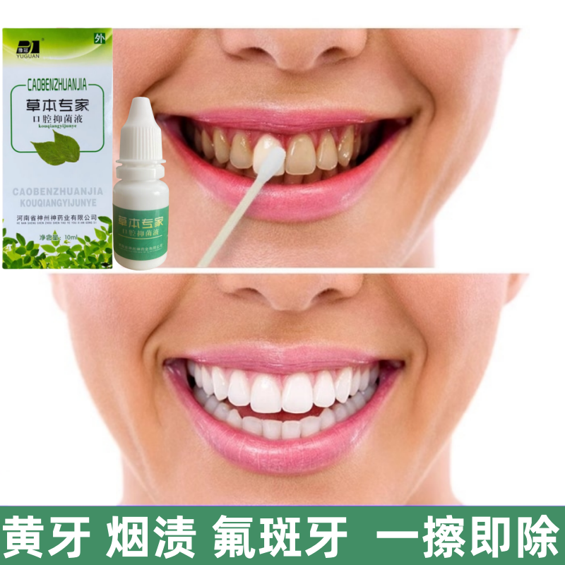 歯の洗浄液、歯のホワイトニング、黄ばんだ歯の素早い除去、タバコのヤニ、茶渋、フッ素症、歯のホワイトニング、歯磨き粉、黄ばんだ歯の除去アーティファクト