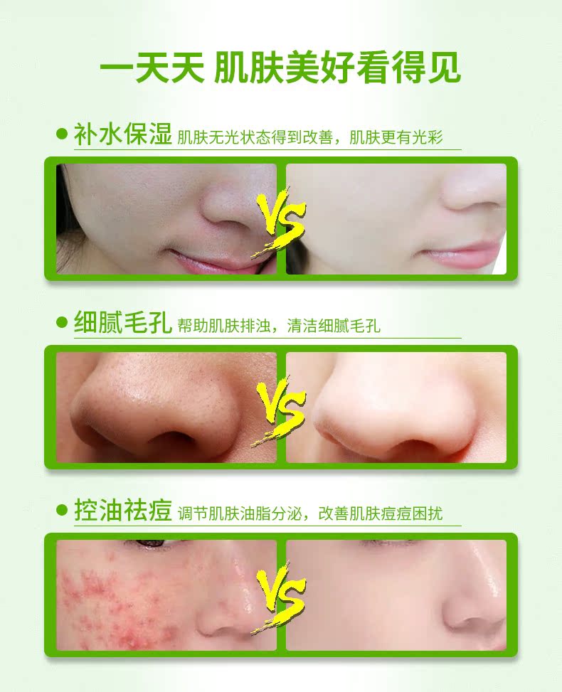 Mặt nạ bùn đậu xanh làm sạch sâu lỗ chân lông kiểm soát dầu co lại thành màng bùn đen trị mụn cho nam và nữ - Mặt nạ kem làm trắng da mặt