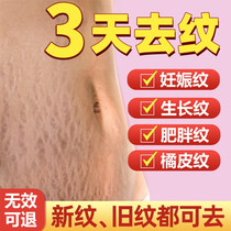 Removing the pregnancy tattooed postpartum repair cream to remove the obese tattooed autachen growth tattooed on the special prevention of the pregnant woman