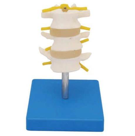 正常腰椎组 合（三节），人体骨骼模型