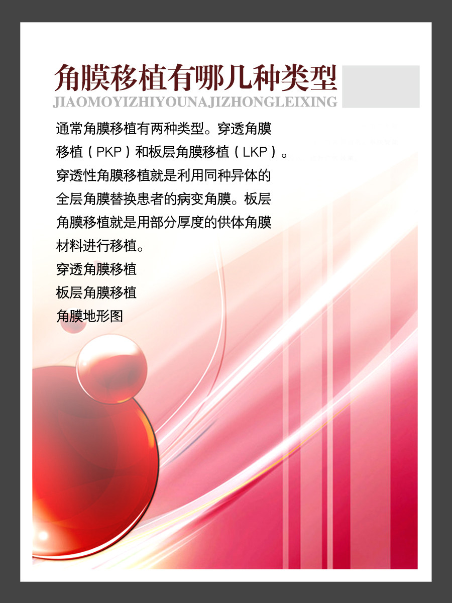 海报印制156素材医院各科室展板79眼科展板