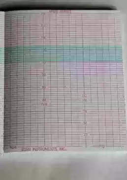 Fetal heart paper fetal monitor paper leppon MFM2-Series jinkewei UT-3000 112*90-150p