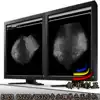 EIZO 21 inch GX340 GS320 medical 3M monochrome black and white grayscale CT professional LCD display