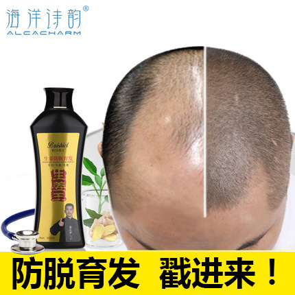 生姜洗发水防脱发控油增发密发男女姜汁头发增长液快速脂溢性掉发