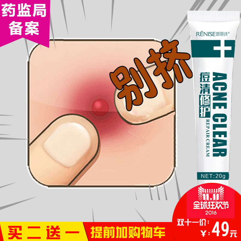 草本祛痘膏男女青春痘去粉刺痘痘快速淡化痘印痘疤控油凹洞霜产品