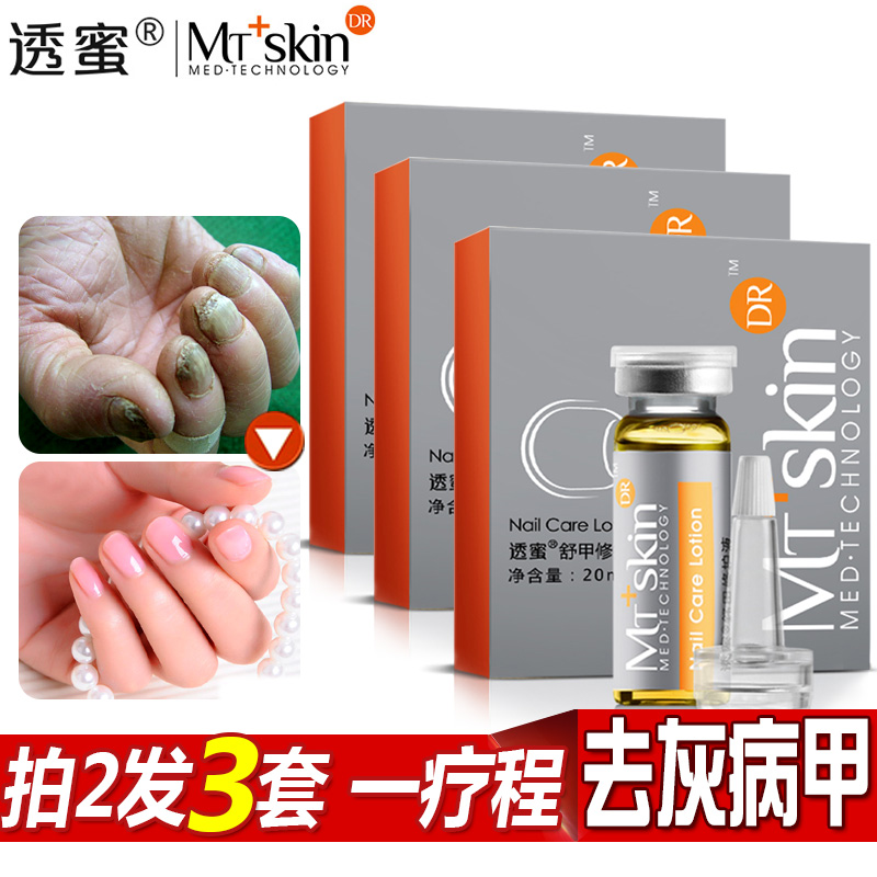 【买2发3】透蜜舒甲液改善去除病指甲专用中药亮甲手足
