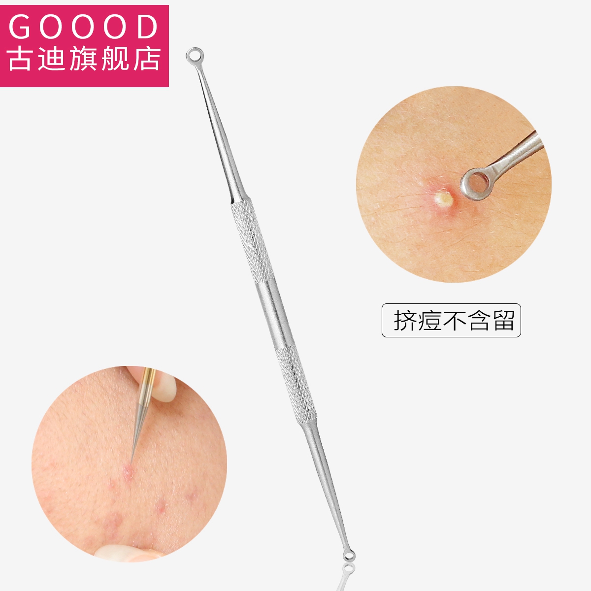挤痘痘粉刺针圈黑头针祛痘压圈暗疮针美容针挤压器黑头圈工具套装