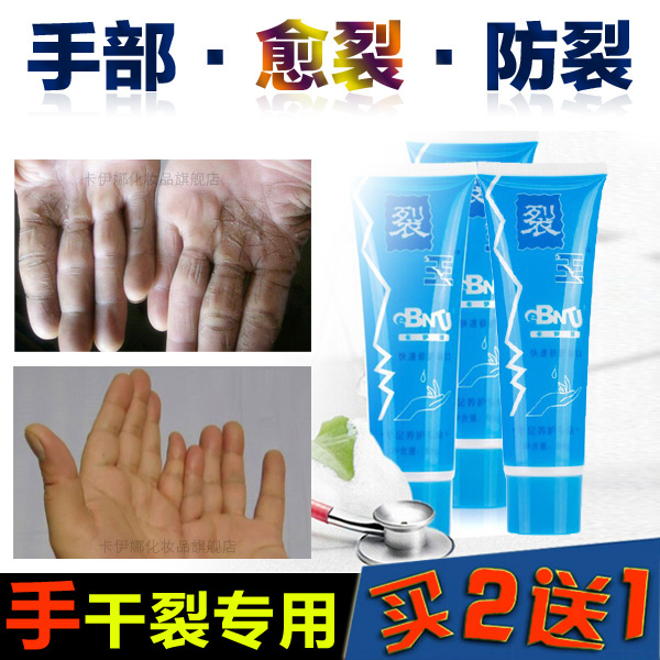 卡伊娜裂王抗裂修复霜倍润护手霜防裂防冻防干裂手霜手裂灵皲裂膏