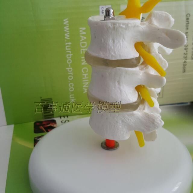 厂家直销 新款3节腰椎模型 腰椎骨骼椎间盘神经根模型