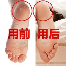 Manufacturer swimming special diving socks Long q cylinder Silicone Moisturizing Involved water socks foot sleeves elastic soft bottom covered water men and women