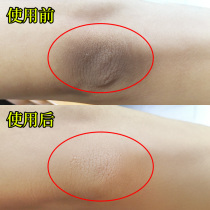 Li Jiaqi recommends joint Black artifact to white female runxuan joint knee underarm black to black artifact