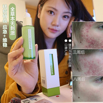 Standing Pimple Pores Small Czech Grass This Face Cream Emulsion Oily Hybrid Pimple Speck Vibe Steady First Aid Feedback Good