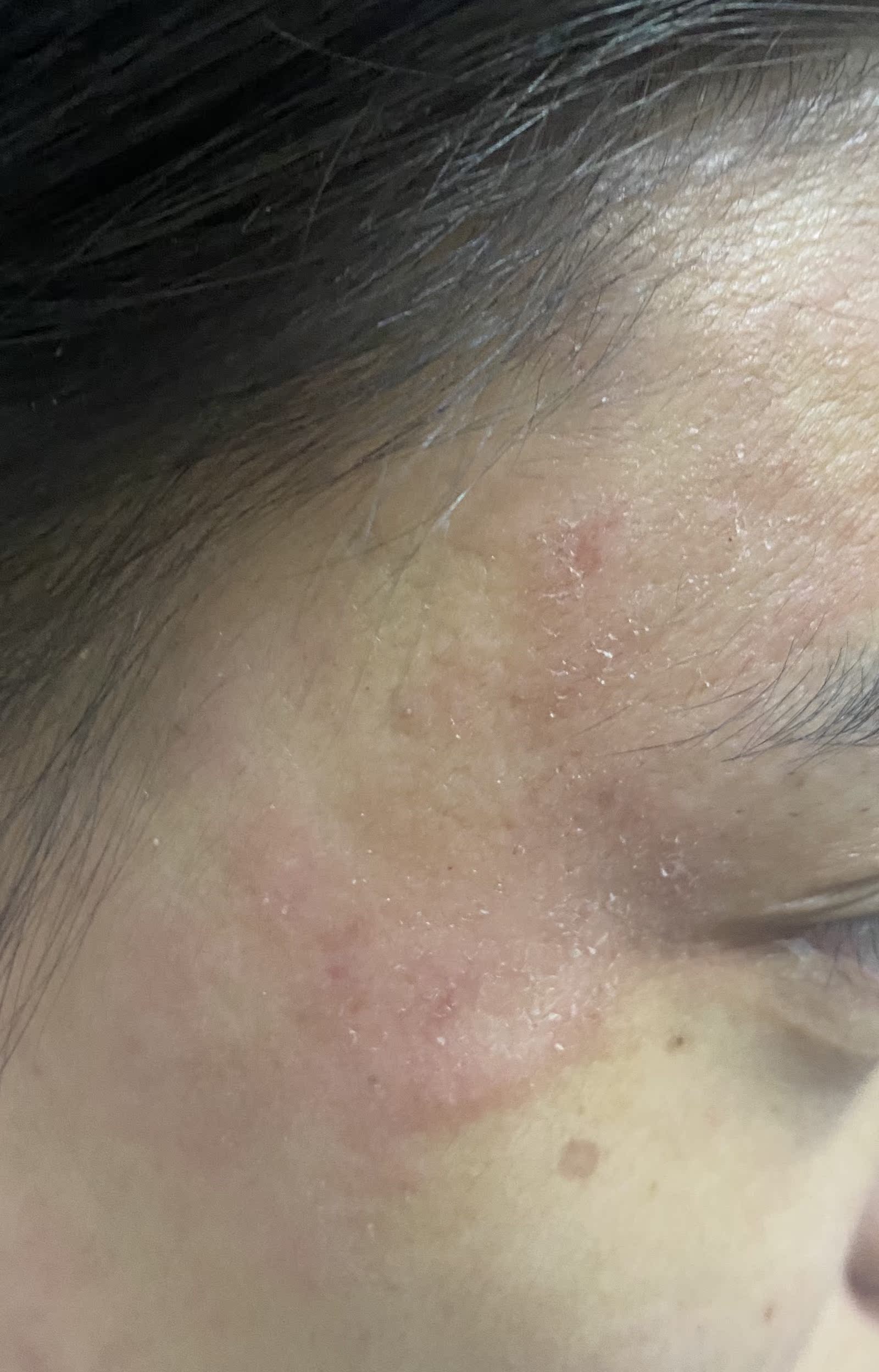 兰蔻极光乳亮白乳液乳液/面霜功能怎样？详细曝光质量如何？