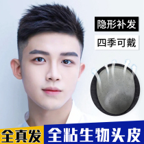 Wig mens short hair hair inch head replacement male real biological scalp forehead bald invisible seamless wig male