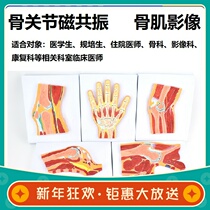 Knee ankle shoulder elbow hip wrist foot whole body small skeletal muscle joint magnetic resonance anatomical MRI slip-film synostic image structure