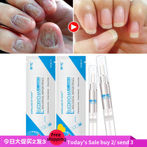  Onychomycosis Nail polish Repairing membrane fluidFinger Nail Polish Repair nail polish Repair Nail polish Repair Nail polish Repair Nail polish Repair Nail polish Repair Nail polish Repair Nail polish Repair Nail polish Repair Nail polish Repair Nail polish Repair Nail polish Repair
