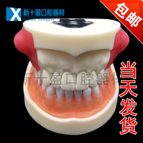 Dental Oral Model Students Exercise Lump Cut Drainage Model Can Replace Lumps Teaching Lumps Model