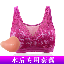 Breast postoperative prosthetic breast special bra two-in-one false breast female silicone bra left and right resection false breast underwear summer