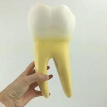 Human molar magnification model split 2 parts dental anatomy toys kindergarten teaching aids dental display