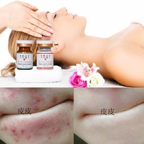  Rescue problem muscles Swiss YMWT seaweed silicone needle Sponge microneedle Acne closed acne scars Pigment pores