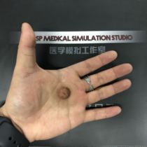 Special nipple for mastectomy Breast cancer resection Nipple repair Nipple repair Female nipple