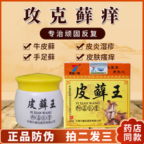 Itchy hands blisters itchy hands blisters peeling chapped hands small blisters seedlings palms and fingers medical antipruritic ointment