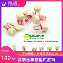 ENOVO Dental Root canal in vitro dental model Dental Endodontics Root canal filling preparation 8 teeth