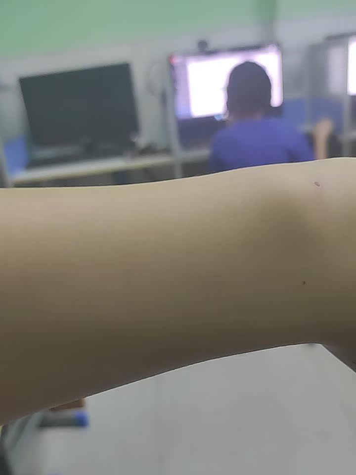 Ulike蓝宝石冰点激光脱毛仪质量坑不坑人，用户揭秘!