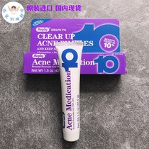 Spot USA Rugby Benzoyl 10% Acne Medication Acne Removing Cream Peroxide