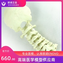 ENOVO simulation human occipital cervical spine anterior and posterior nail plate system training operation demonstration Orthopedic hand