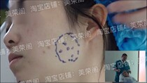 Professor Sun Hyaluronic acid filled botulinum toxin wrinkle injection learning tutorial professional beauty HD