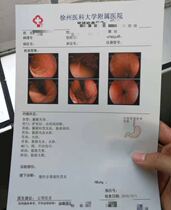 Gastroscope software Colonoscopy software Gastrointestinal endoscopy software Gastroscopy HD software Endoscopy free software Win7
