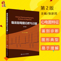 Clinical electrocardiogram analysis and diagnosis 2nd Edition Zhang Xinmin Editor-in-chief Suitable as an electrocardiogram textbook for junior and senior electrocardiograph personnel Book Internal medicine electrocardiogram books Reference book Peoples Republic of China