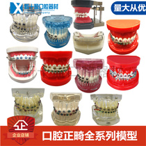 Dental Oral Model Transparent Misjaw Dental Cog Display Model Ligation Silk Togroove Dental Mold With anti-nail tooth column