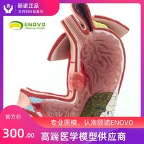 ENOVO medical gastric disease demonstration model Human stomach anatomy Digestive system model Gastroenterology