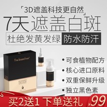 White spot concealer Cream concealer Face and hand Long-lasting waterproof anti-sweat artifact promotes external melanin growth