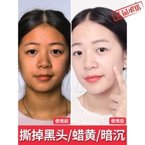 Weiya recommends facial mask whitening moisturizing moisturizing yellowing whitening skin tone deep cleansing mud film