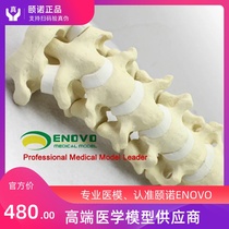 ENOVO Orthopedic simulation human cervical spine model Medical orthopedic surgery simulation bone cervical spine anterior and posterior