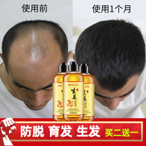 Ginger shampoo anti-hair loss hair growth Ginger Juice Control Oil Fluffy to dandruff and Shampoo Dew-Flagship Store