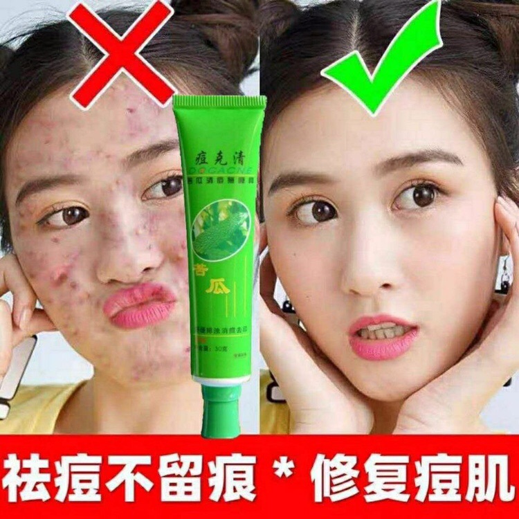 Lulanjina balsam pear acne clearing and eliminating acne cream acne closed acne herbal essence two discount