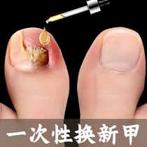 Tongrentang hot sale---no guarantee or repair turn bad nails into good nails grow new nails enjoy the life of good nails currently active