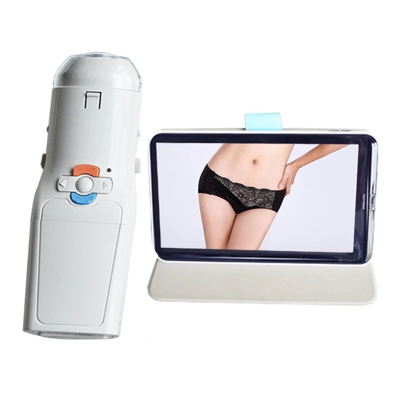 Private Inspection Instruments Vagina Lens lens Self-inspection instrument 2 million HD lens